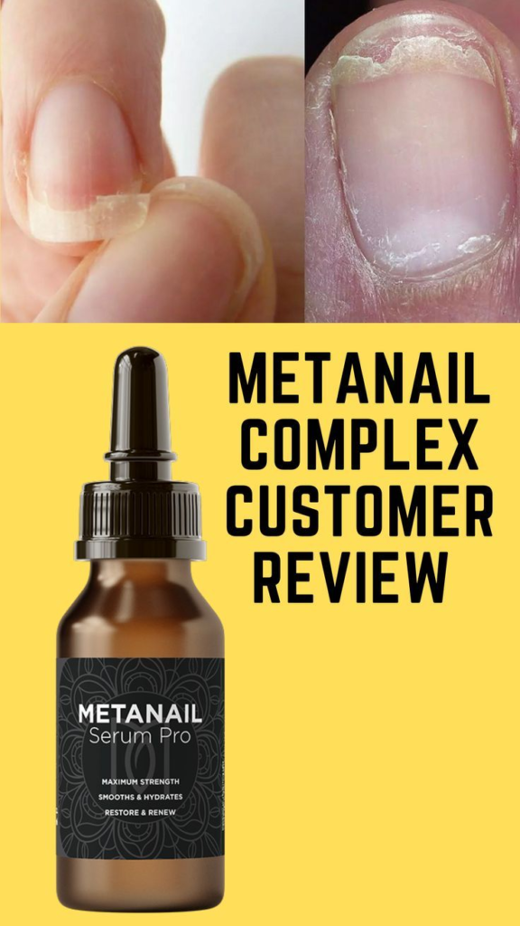 Metanail Complex Review